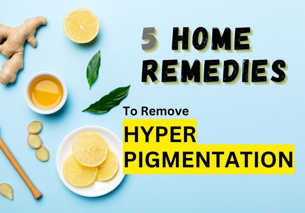 Home Remedies For Hyperpigmentation